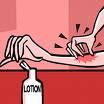 Skin condition